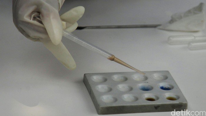 **Teman Onadio Leonardo Positif Narkoba, Jalani Tes Urine Setelah Ditangkap Polisi**