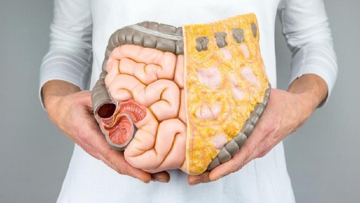 Makanan Ini Jadi Penyebab Utama Kanker Usus Besar pada Generasi Z