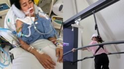 Wanita Jaksel Berusia 27 Tertimpa Tumor Otak, Inilah Gejala Pertamanya yang Jarang Disadari!