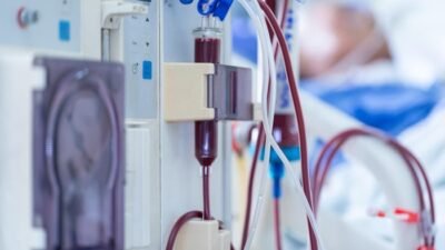 160 Pasien Gagal Ginjal Terhambat Berobat Akibat PBI BPJS Nonaktif