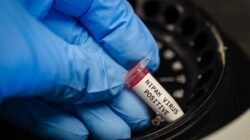 Ngeri Virus Nipah Makan Korban di Bangladesh, Eks Petinggi WHO Soroti Hal Ini – Update 1