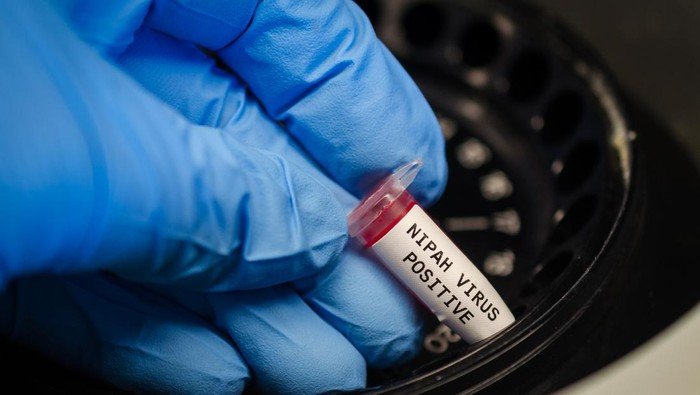 Ngeri Virus Nipah Makan Korban di Bangladesh, Eks Petinggi WHO Soroti Hal Ini - Update 1