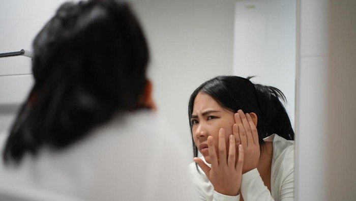 Diet Rendah Gula Bisa Atasi Jerawat? Ini Faktanya!