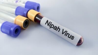 Kronologi Meninggalnya Korban Virus Nipah di Bangladesh: Dari Demam ke Tragedi Meninggal