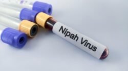 **Kronologi Pasien Meninggal Terpapar Virus Nipah di Bangladesh, Keluhkan Gejala Ini**