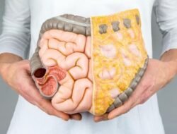 Tren Kanker Usus Besar di Usia Muda Makin Mengkhawatirkan: Kenali Gejala dan Langkah Pencegahannya