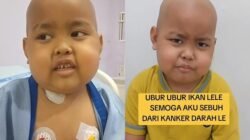 **Awal Mula Devin Bocah di Bogor Idap Leukemia, Ayah Singgung Pola Makan UPF**