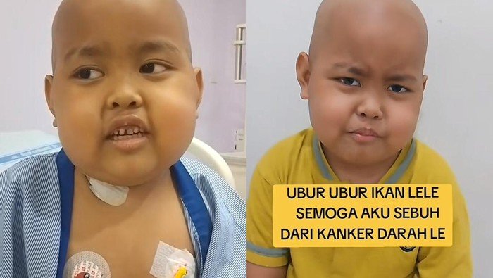 **Awal Mula Devin Bocah di Bogor Idap Leukemia, Ayah Singgung Pola Makan UPF**