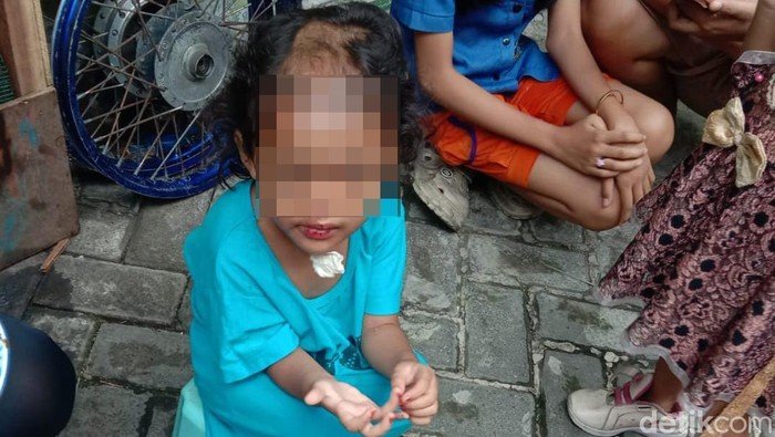Pilu Nasib Balita Dianiaya-Dibotaki Paman dan Bibi di Surabaya: Tragedi yang Menggetarkan Hati