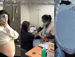 “Perut Buncit Tanda Kista? Dokter Spesialis Obgyn Di Surabaya Ungkap Kejutan untuk Wanita”