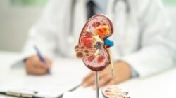 Perut Buncit pada Anak: Waspadai Tanda Kanker Ginjal atau Hanya Masuk Angin?