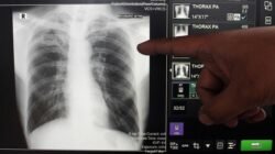 1. “Fakta-Fakta Klaim Sesat Influencer Tentang Herbal Sebagai Obat TBC”