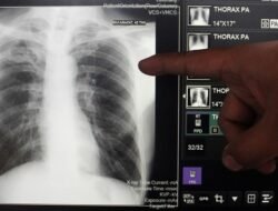 1. “Fakta-Fakta Klaim Sesat Influencer Tentang Herbal Sebagai Obat TBC”